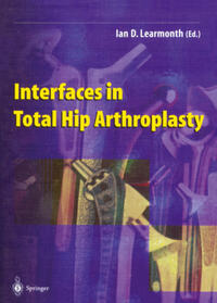 Vorderes Coverbild Interfaces in Total Hip Arthroplasty