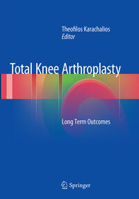 Vorderes Coverbild Total Knee Arthroplasty