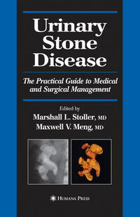 Vorderes Coverbild Urinary Stone Disease
