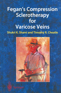 Vorderes Coverbild Fegan’s Compression Sclerotherapy for Varicose Veins