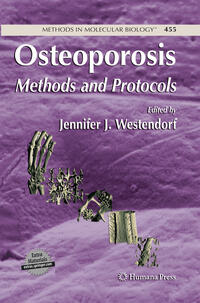 Vorderes Coverbild Osteoporosis