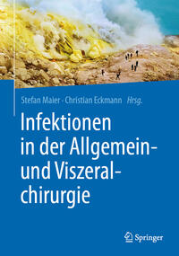 Vorderes Coverbild Infektionen in der Allgemein- und Viszeralchirurgie