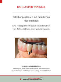 Vorderes Coverbild Teleskopprothesen auf natürlichen Pfeilerzähnen - Eine retrospektive Überlebenszeitanalyse von Zahnersatz aus einer Zahnarztpraxis