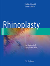 Vorderes Coverbild Rhinoplasty