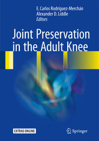 Vorderes Coverbild Joint Preservation in the Adult Knee