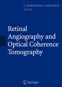 Vorderes Coverbild Retinal Angiography and Optical Coherence Tomography
