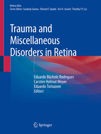 Vorderes Coverbild Trauma and Miscellaneous Disorders in Retina