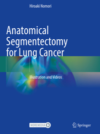 Vorderes Coverbild Anatomical Segmentectomy for Lung Cancer