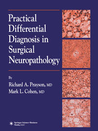Vorderes Coverbild Practical Differential Diagnosis in Surgical Neuropathology