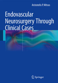 Vorderes Coverbild Endovascular Neurosurgery Through Clinical Cases