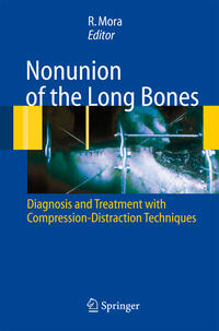 Vorderes Coverbild Nonunion of the Long Bones