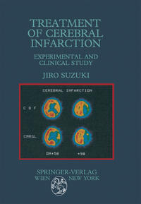 Vorderes Coverbild Treatment of Cerebral Infarction