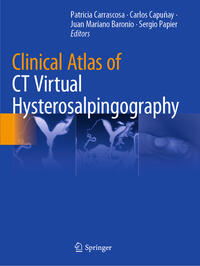 Vorderes Coverbild Clinical Atlas of CT Virtual Hysterosalpingography