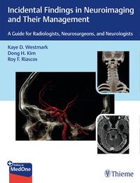 Vorderes Coverbild Incidental Findings in Neuroimaging and Their Management