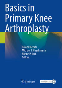 Vorderes Coverbild Basics in Primary Knee Arthroplasty