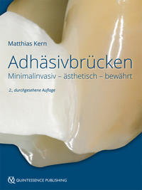 Vorderes Coverbild Adhäsivbrücken