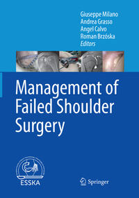 Vorderes Coverbild Management of Failed Shoulder Surgery