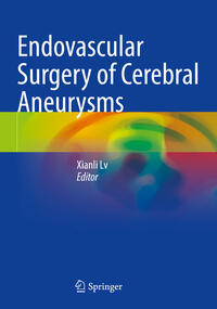 Vorderes Coverbild Endovascular Surgery of Cerebral Aneurysms