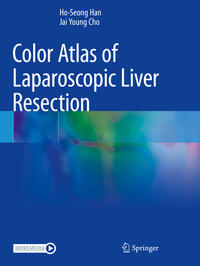 Vorderes Coverbild Color Atlas of Laparoscopic Liver Resection
