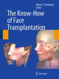 Vorderes Coverbild The Know-How of Face Transplantation
