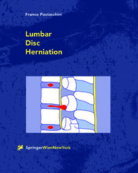 Vorderes Coverbild Lumbar Disc Herniation