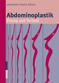 Vorderes Coverbild Abdominoplastik