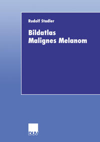 Vorderes Coverbild Bildatlas Malignes Melanom