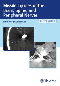 Vorderes Coverbild Missile Injuries of the Brain, Spine, and Peripheral Nerves