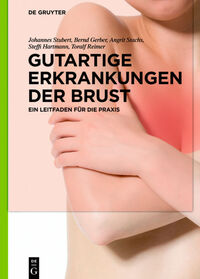 Vorderes Coverbild Gutartige Erkrankungen der Brust