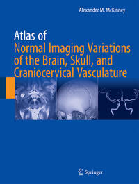 Vorderes Coverbild Atlas of Normal Imaging Variations of the Brain, Skull, and Craniocervical Vasculature