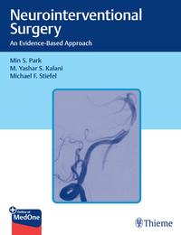 Vorderes Coverbild Neurointerventional Surgery