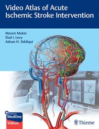 Vorderes Coverbild Video Atlas of Acute Ischemic Stroke Intervention