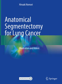 Vorderes Coverbild Anatomical Segmentectomy for Lung Cancer