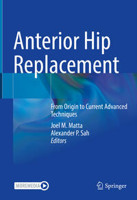 Vorderes Coverbild Anterior Hip Replacement