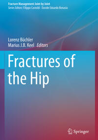 Vorderes Coverbild Fractures of the Hip