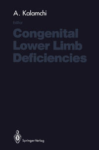Vorderes Coverbild Congenital Lower Limb Deficiencies