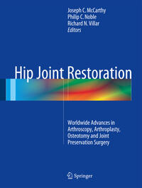 Vorderes Coverbild Hip Joint Restoration