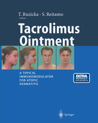 Vorderes Coverbild Tacrolimus Ointment
