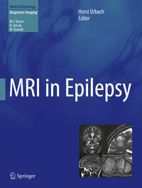 Vorderes Coverbild MRI in Epilepsy