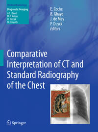 Vorderes Coverbild Comparative Interpretation of CT and Standard Radiography of the Chest
