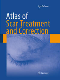 Vorderes Coverbild Atlas of Scar Treatment and Correction