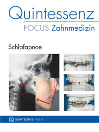 Vorderes Coverbild Schlafapnoe