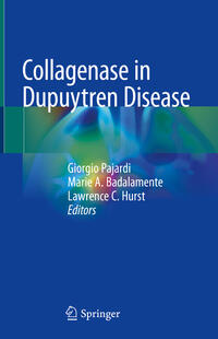 Vorderes Coverbild Collagenase in Dupuytren Disease