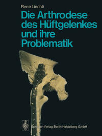 Vorderes Coverbild Die Arthrodese des Hüftgelenkes und ihre Problematik