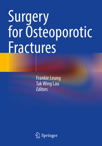 Vorderes Coverbild Surgery for Osteoporotic Fractures