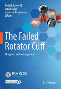 Vorderes Coverbild The Failed Rotator Cuff