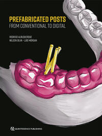 Vorderes Coverbild Prefabricated Posts