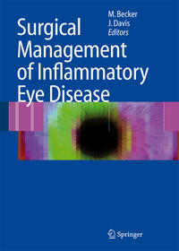 Vorderes Coverbild Surgical Management of Inflammatory Eye Disease