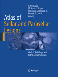 Vorderes Coverbild Atlas of Sellar and Parasellar Lesions