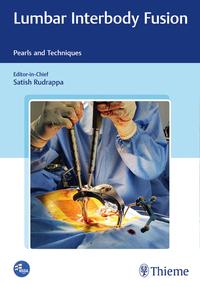 Vorderes Coverbild Lumbar Interbody Fusion